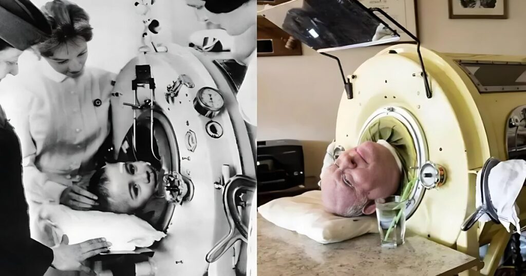 The Polio Epidemic and the Iron Lung