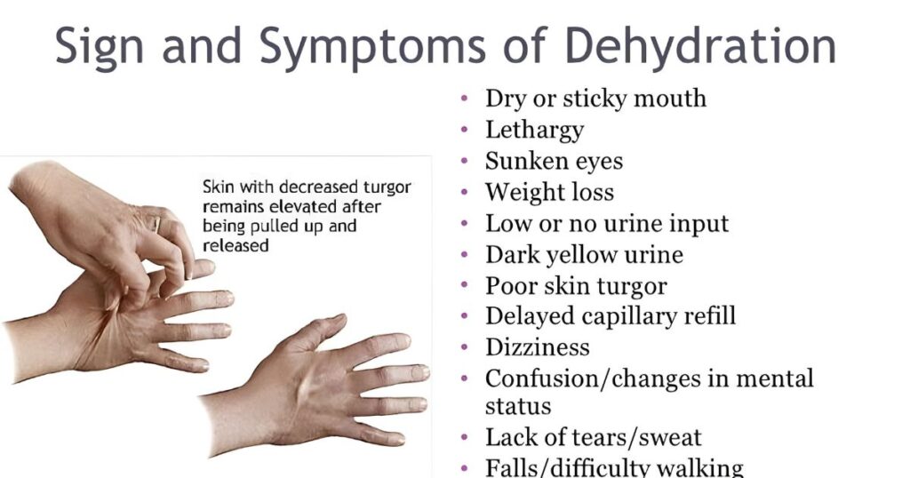 Dehydration: Signs and Symptoms